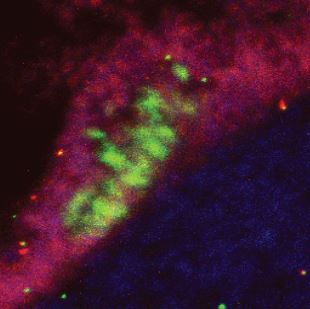 外周神經幹細胞
 